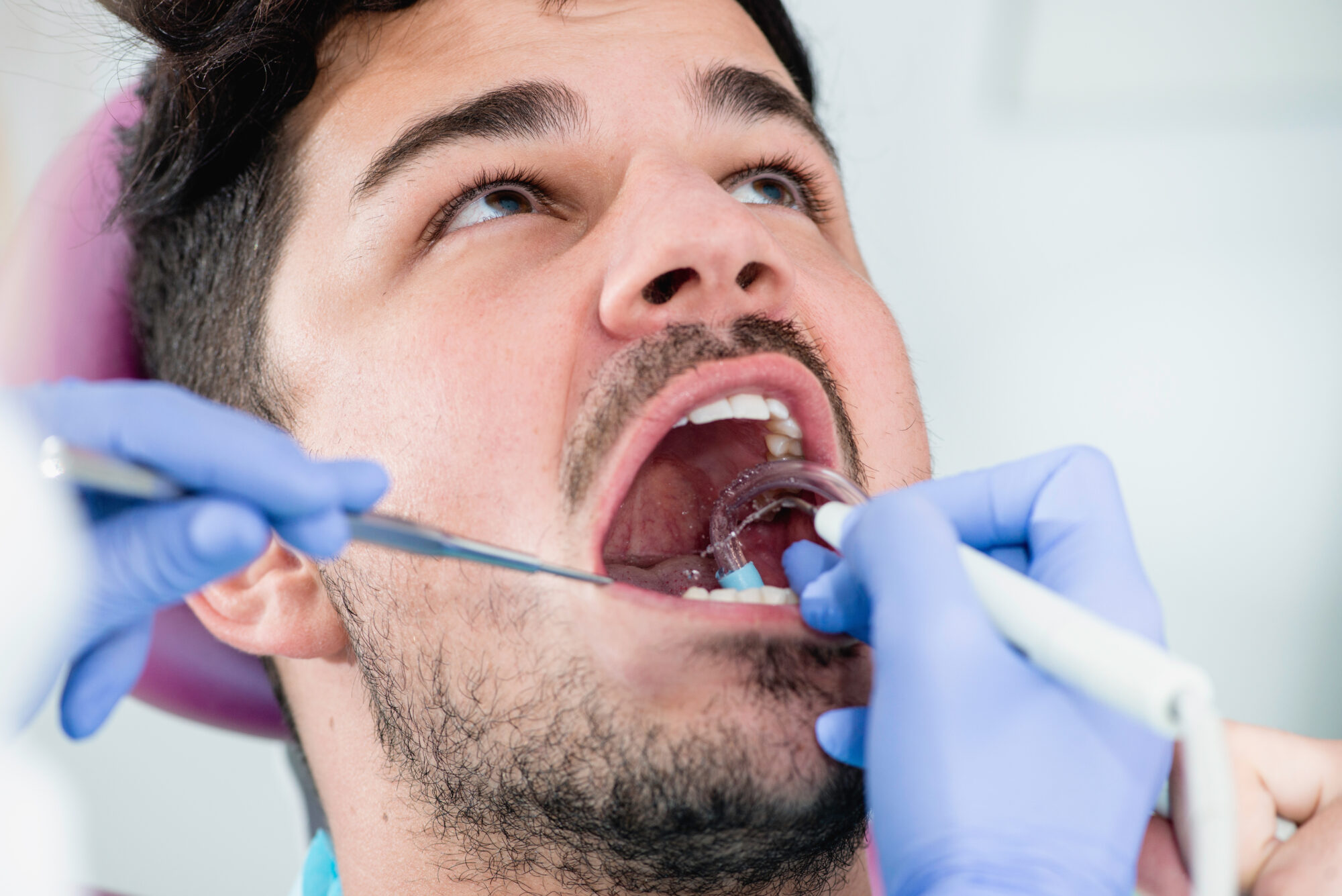 What to know about professional teeth cleaning?