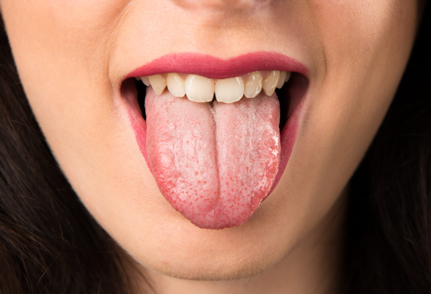 Why is it important to brush your tongue?