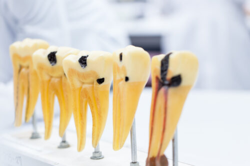 Tooth model for education in laboratory